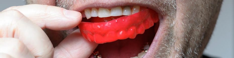 Pros and Cons of using Off-the-shelf mouth guards
