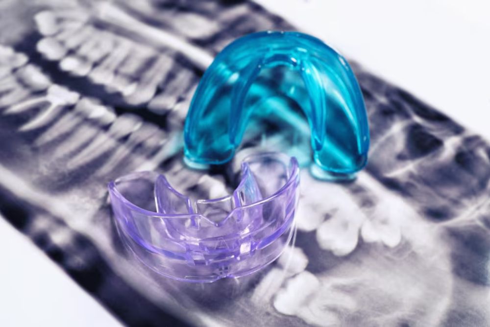 Difference Between Custom Mouth Guards and Shelf Sports Mouth Guards