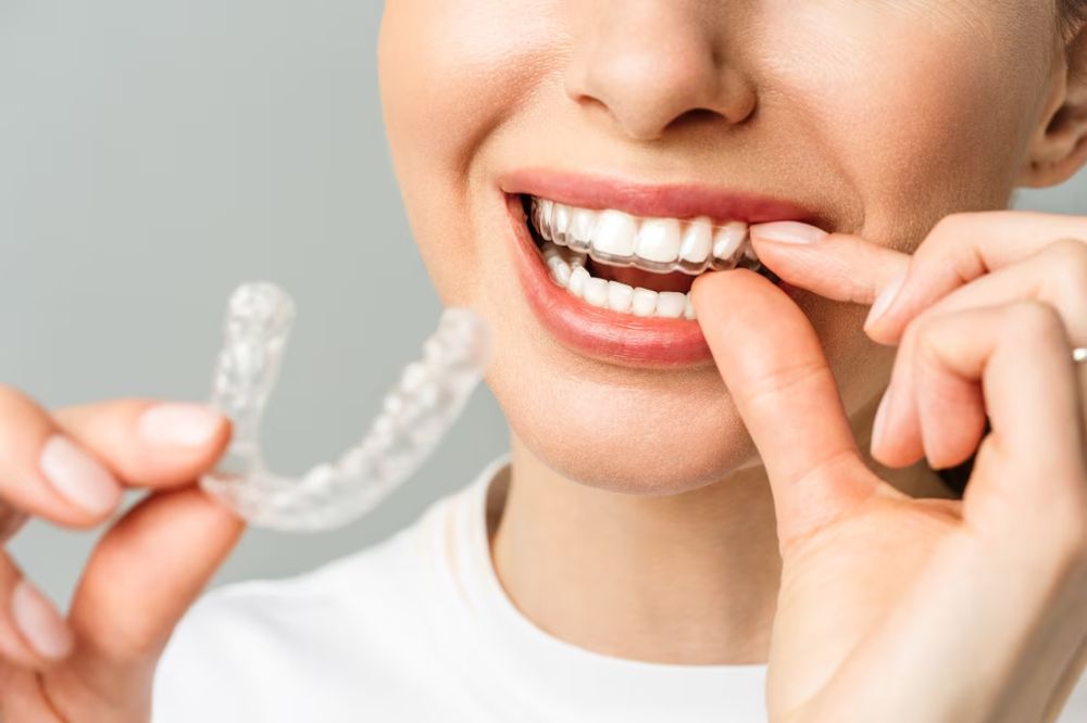 Invisalign near you